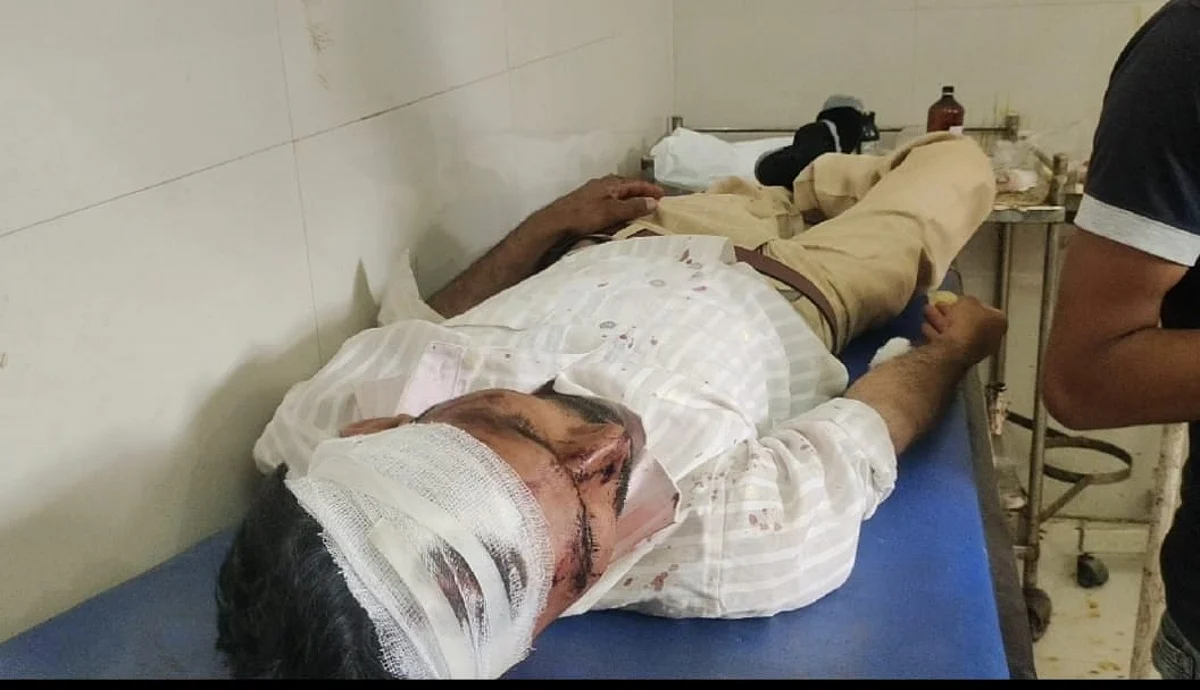 चुनावी रंजिश में दो पक्षों में हुई जमकर मारपीट, दो लोग घायल