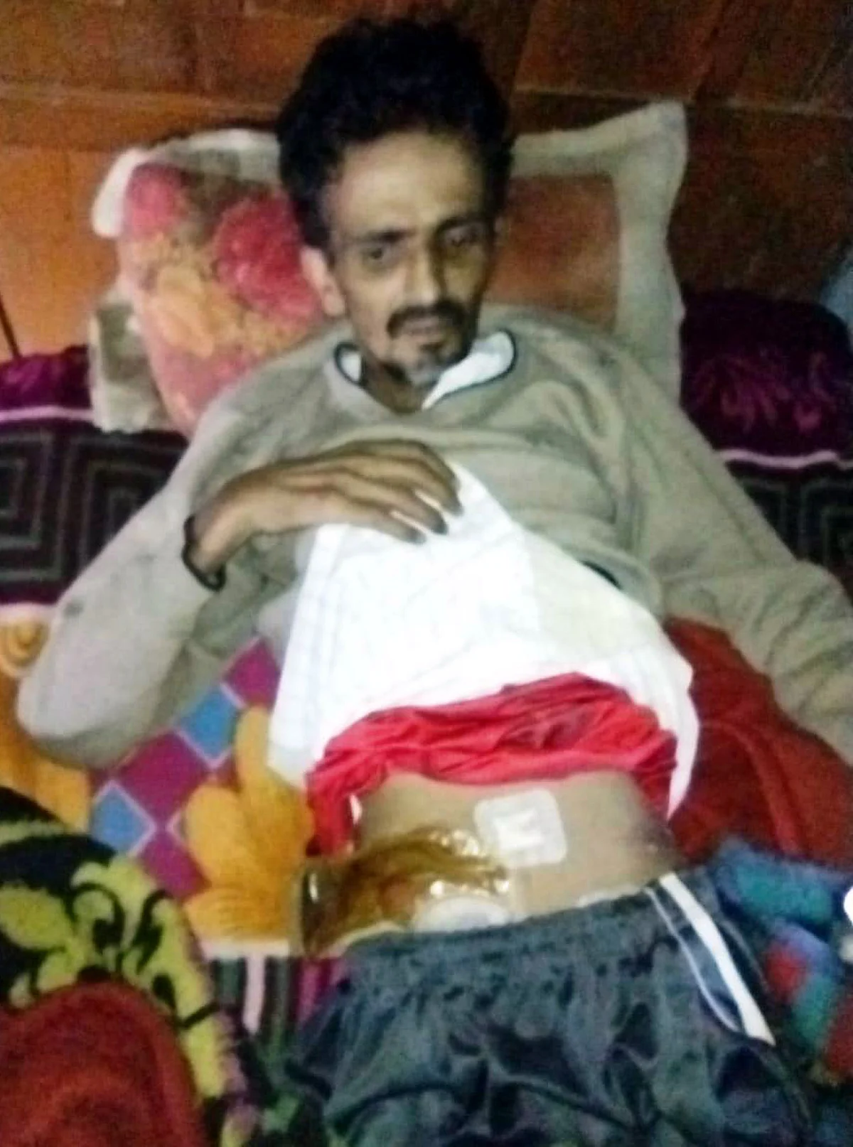 अग्नाशय पीड़ित दो छोटे बच्चों के पिता के लिए मदद की गुहार