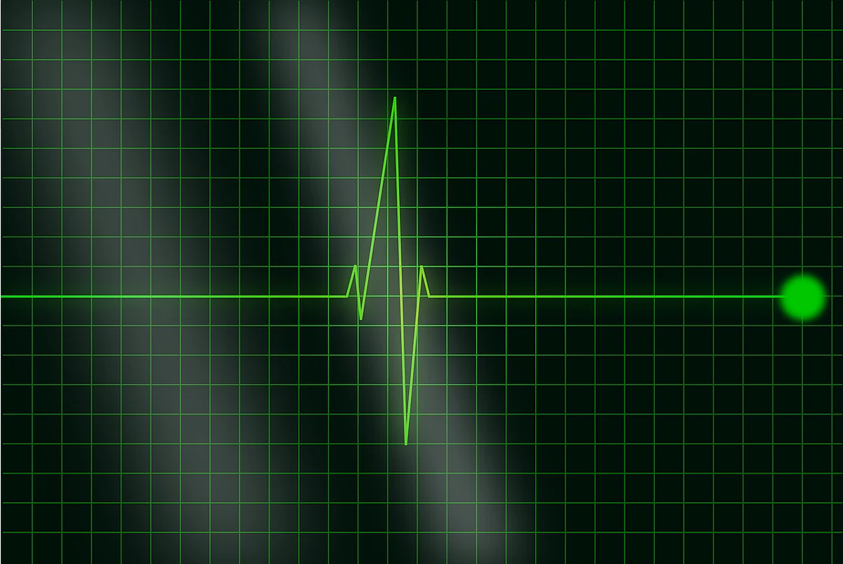 इलेक्ट्रोकार्डियोग्राम या ईसीजी - Electrocardiogram Ya Ecg in Hindi