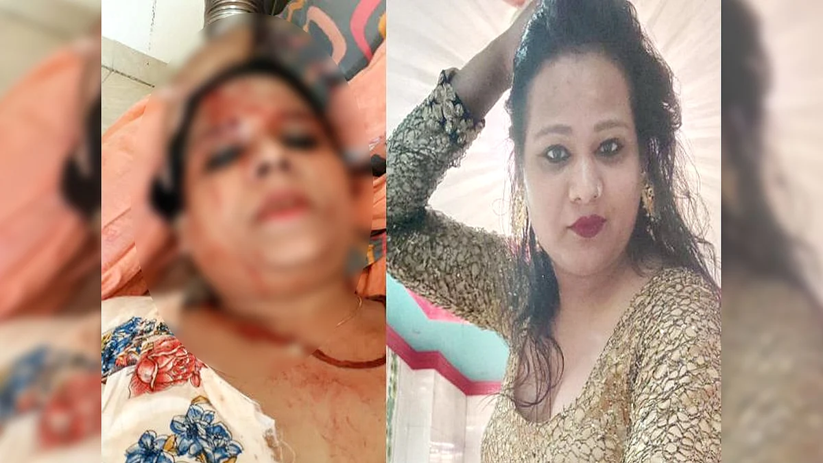किन्नरों ने एक दूसरे पर किया हमला, लहुलुहान हालत में देवी सिंह पहुंची थाने