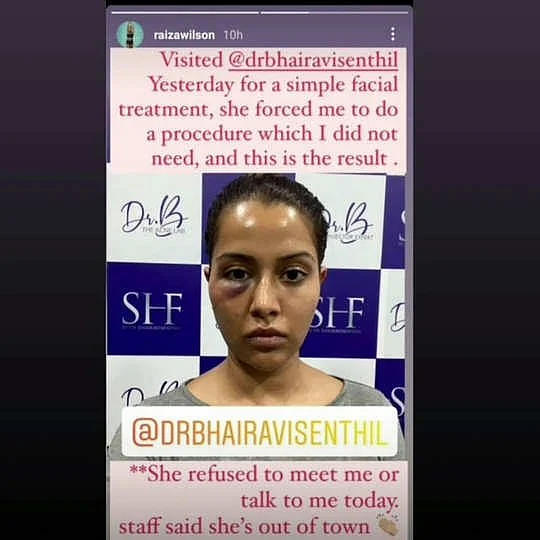 तमिल एक्ट्रेस रायजा विल्सन का बिगड़ा चेहरा, महंगा पड़ा फेशियल ट्रीटमेंट