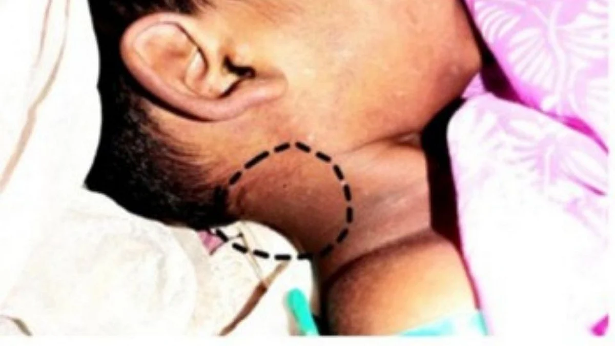 बालिकेच्या अंथरूणात दोन साप..गळ्यावर दंश केल्याने काही क्षणात मृत्यू