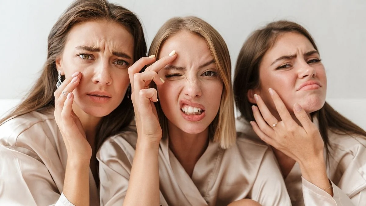 Skin Care : उन्हाळ्यात वाढणाऱ्या पिंपल्सच्या समस्यांना अशा पद्धतीने रोखा