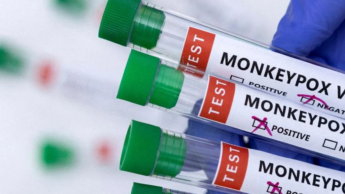 Monkeypox: मंकीपॉक्सची लक्षणे दिसल्यास काय कराल? तुमच्या मनातील प्रश्नांची उत्तरे जाणून घ्या