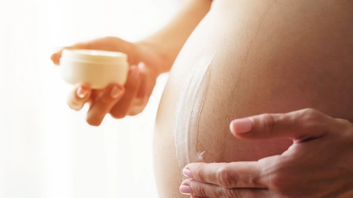 Stretch marks, Post pregnancy tips, skin care, skin care tips