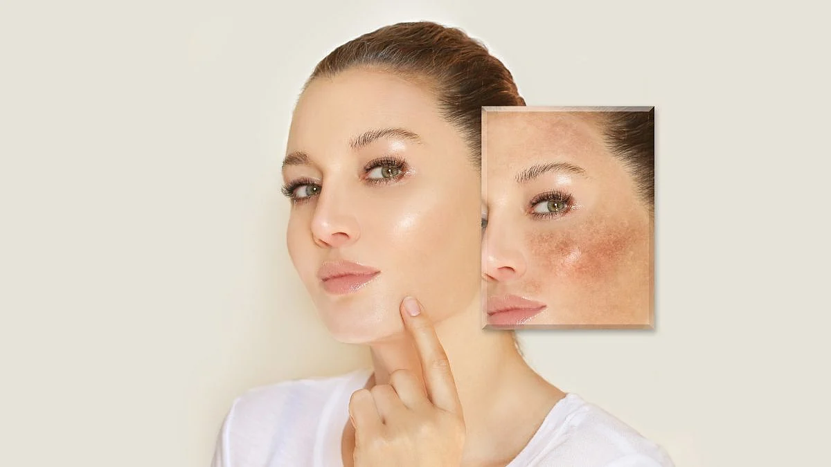Health tips, Skin care, Skin care tips