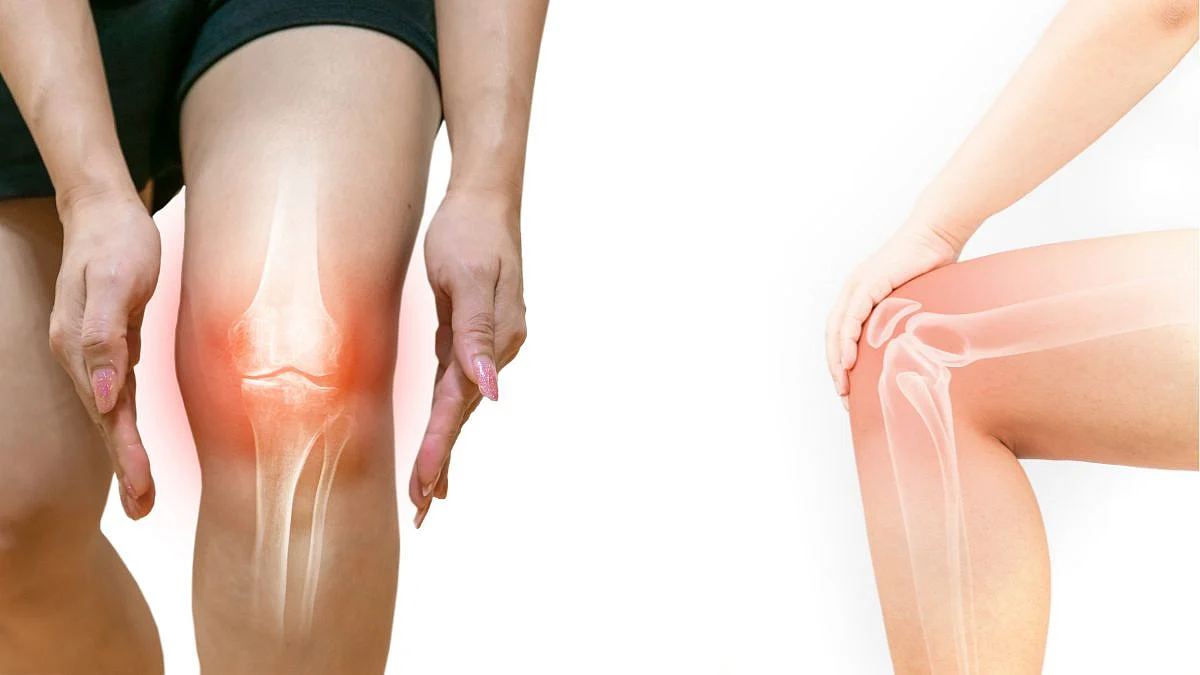 Bones Health Tips, Health tips, Health care