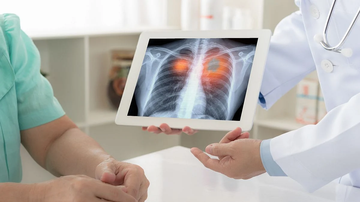 World lung cancer day, Lung health, Health tips