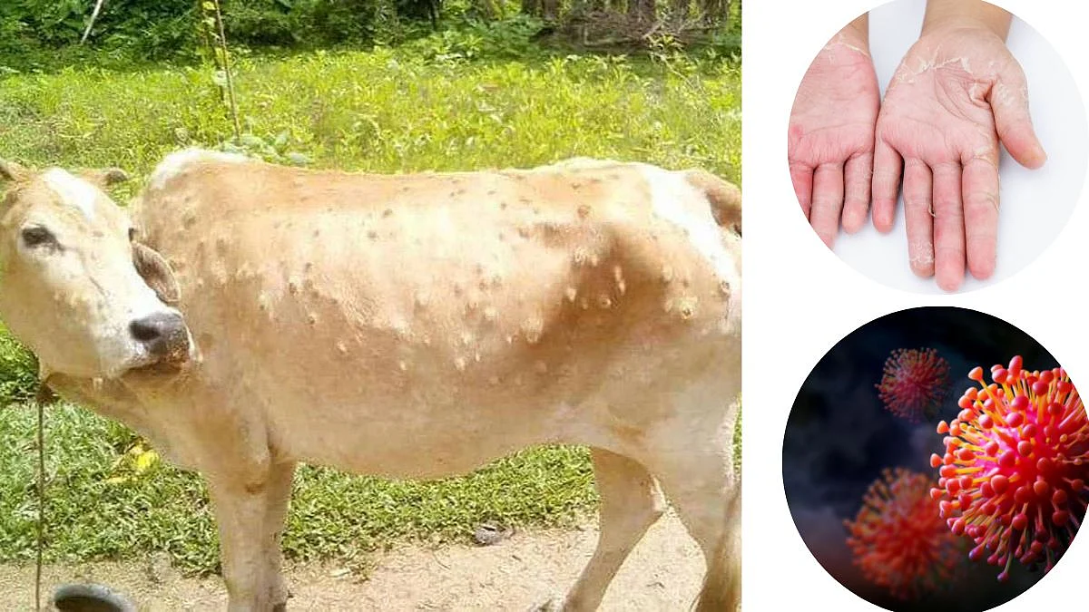 Lumpy Virus