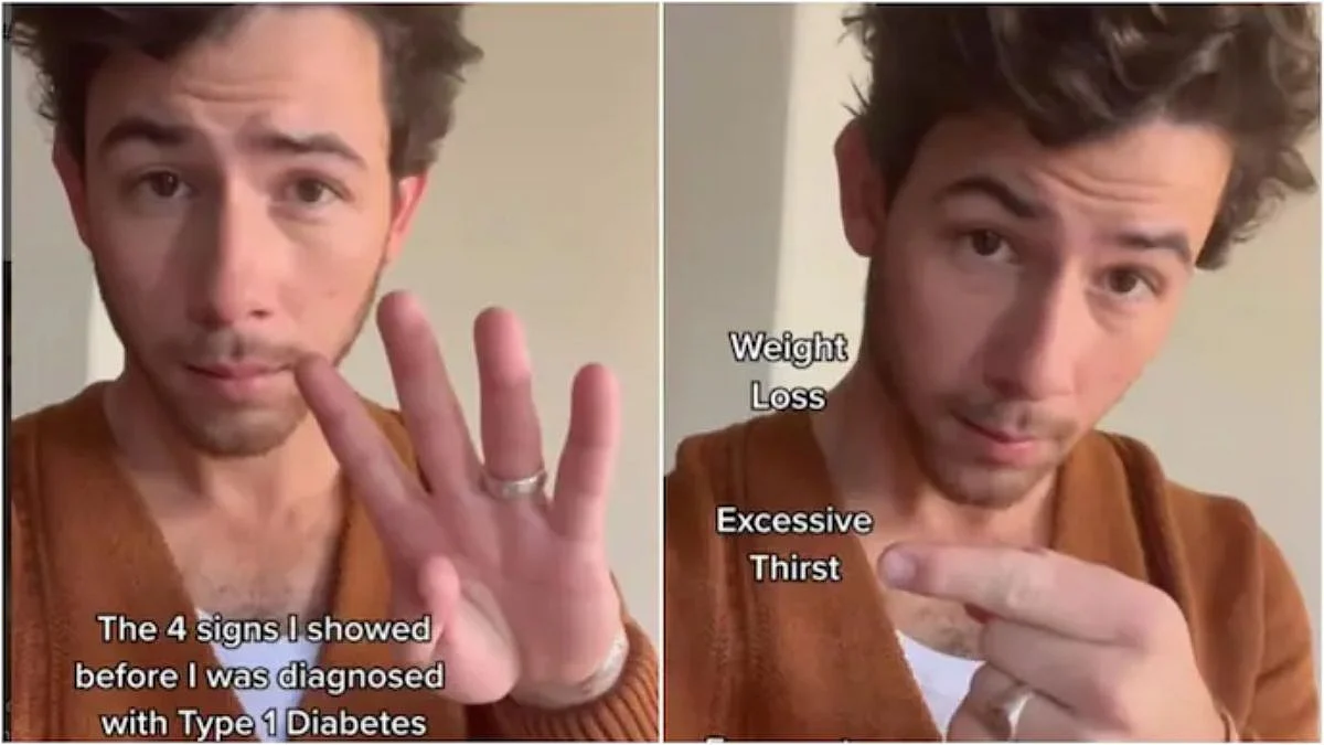 Nick Jonas Video