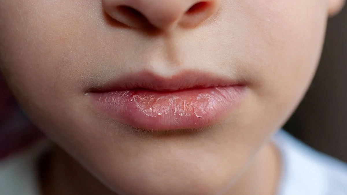 Lip Care