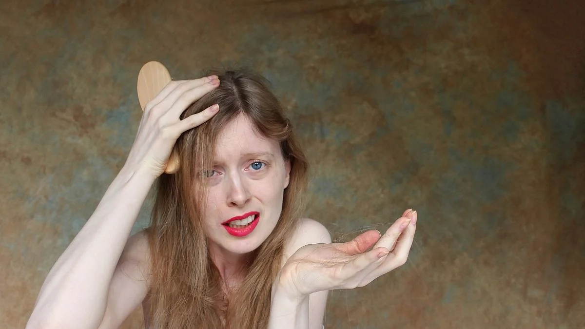 Hair Loss affects Mental Health
