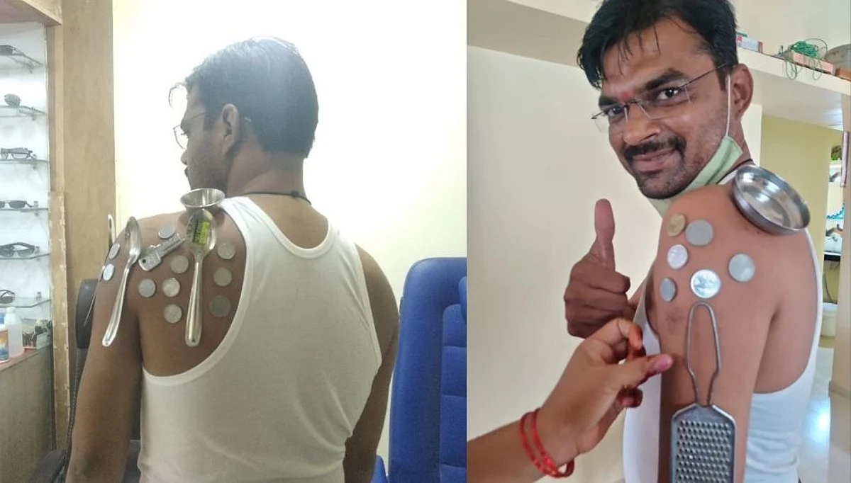 नाशिकनंतर परभणीतही अजब प्रकार! लस घेतलेल्या व्यक्तीच्या अंगाला चिकटले नाणे