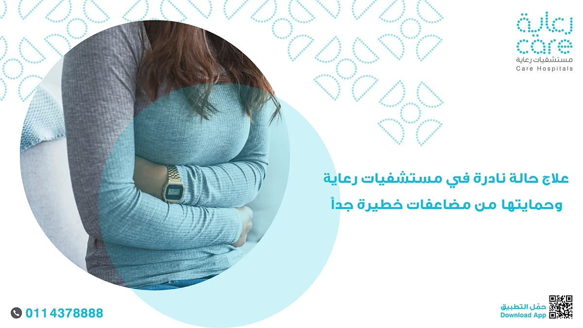 أنقذتها من مضاعفات خطرة.. جراحة ناجحة برعاية الملز لعلاج حالة نادرة لمريضة عشرينية