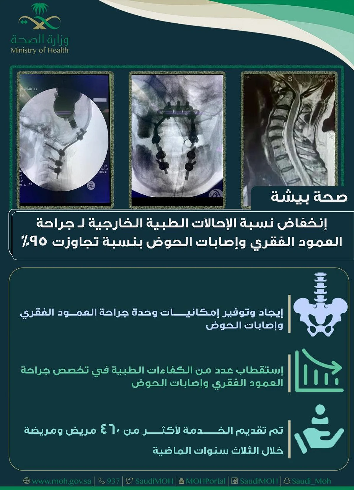 "صحة بيشة": انخفاض نسبة الإحالات الطبية الخارجية لجراحة العمود الفقري وإصابات الحوض بنسبة تجاوزت 95%