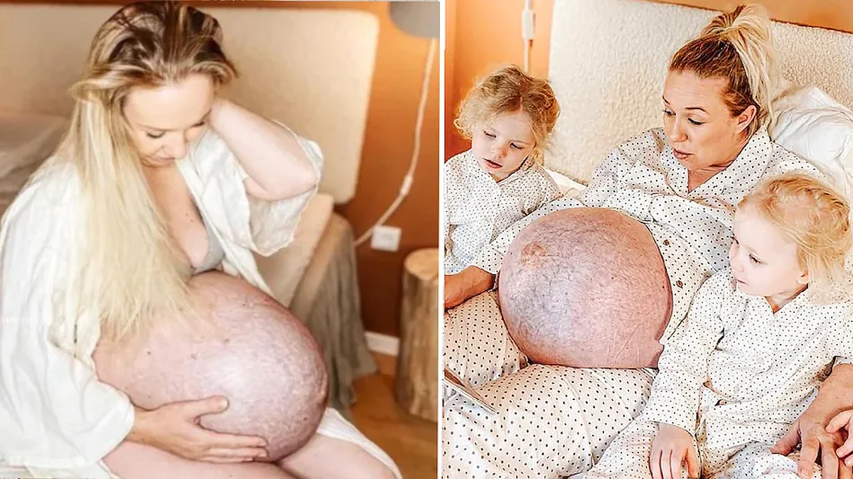 Why People Calling 21-Year-Old Pregnant Woman a Superhero...