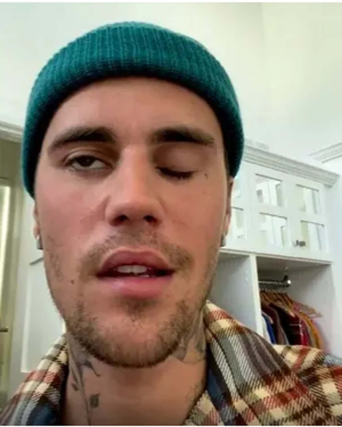 Get Well Soon Justin Bieber: Canadian Singer diagnosed with Ramsay Hunt Syndrome, himself shared on Social Media