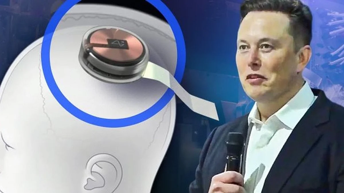 Neuralink: Musk Going To Install This Chip In His Brain, Know How Will It Work
