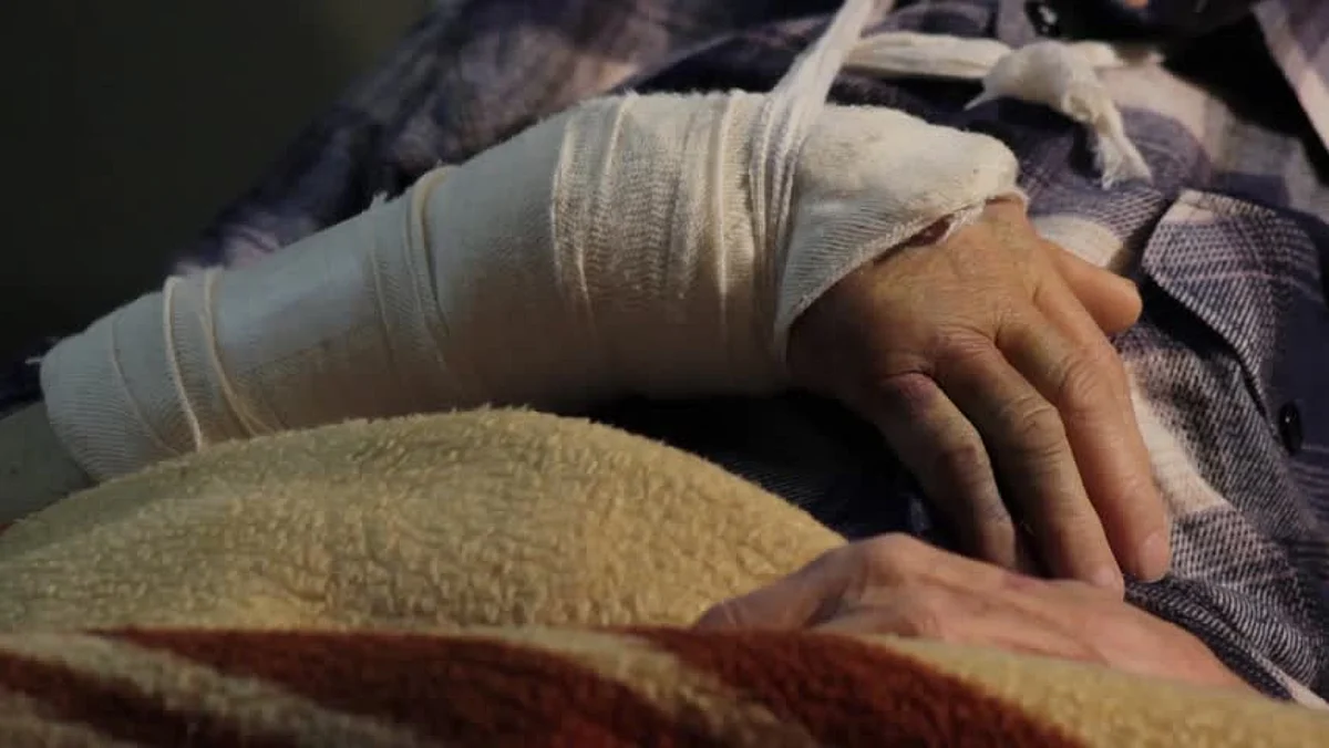 Medical Negligence in Bihar: Left Hand Fractured, Plaster Cast on Right