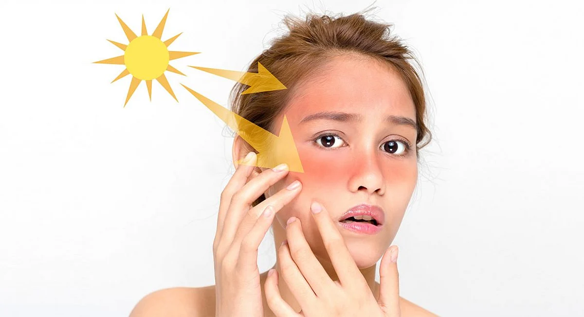Simple Tips to Get Rid of Skin Tanning