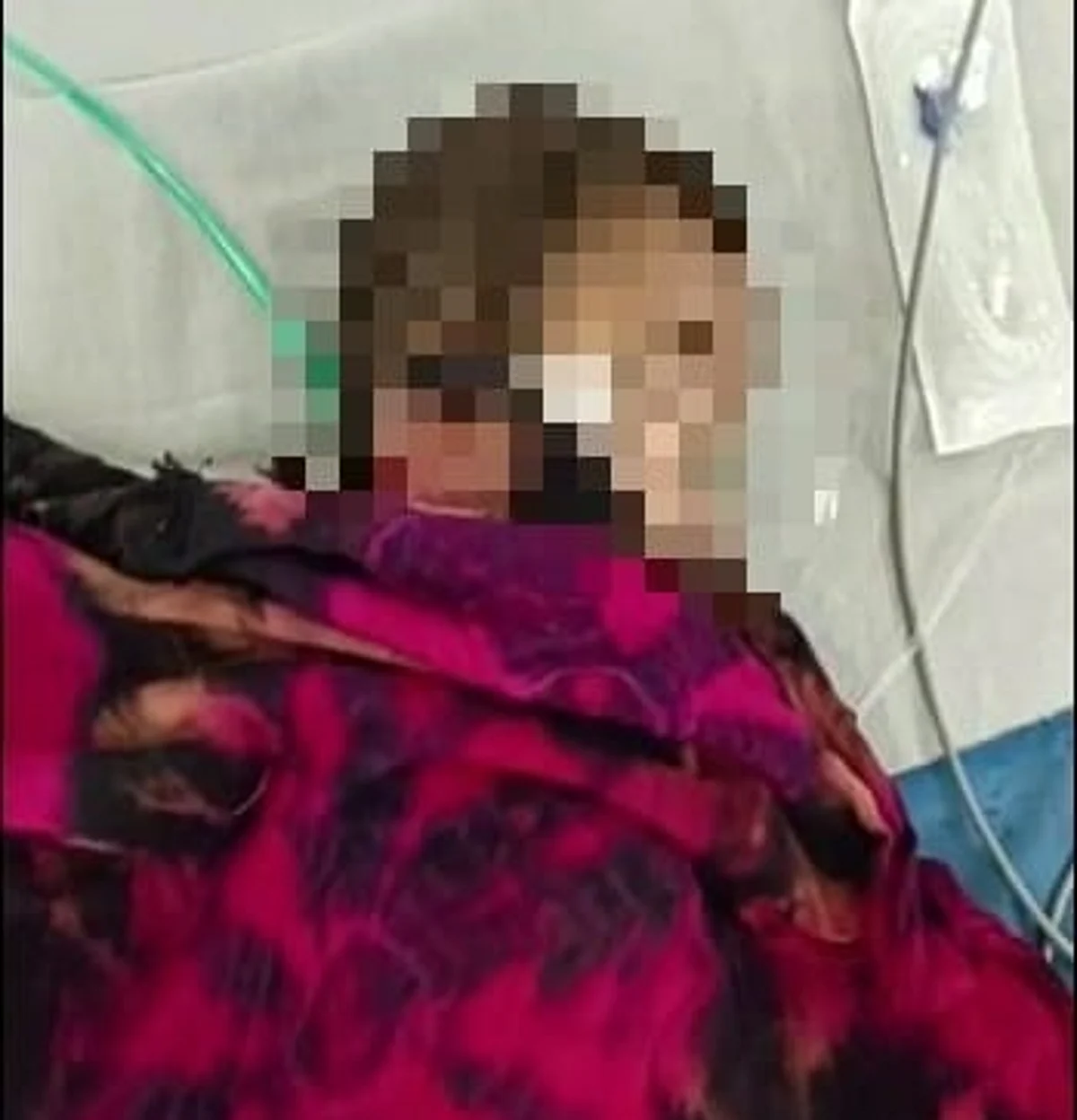 8 माह के नवजात को अंधविश्वास की सजा : परिजन ने गर्म तार से दागा‚ हालत बिगड़ी‚ जानिए पूरा मामला