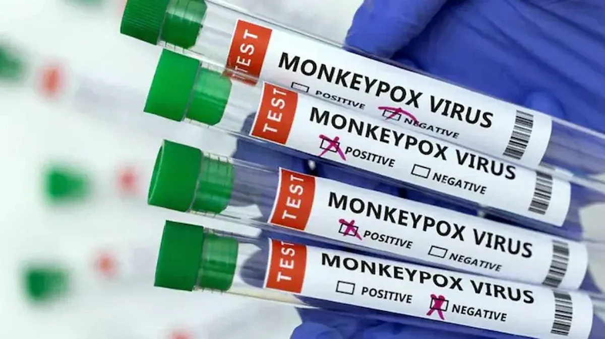 Monkeypox महामारी घोषित! वर्ल्ड हेल्थ नेटवर्क ने WHO को दिए संकेत, भारत को भी सतर्क होने की जरुरत