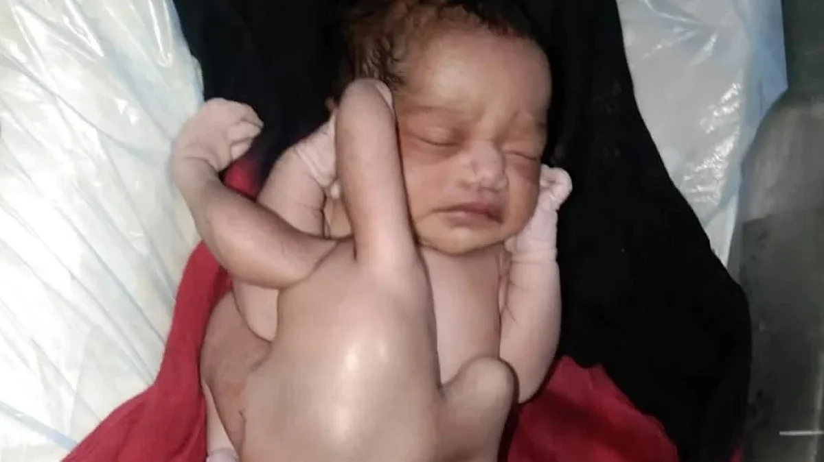 UP: हरदोई में जन्मा अनोखा बच्चा, देखने के लिए जुटी भीड़, लोग बता रहे भगवान का अवतार
