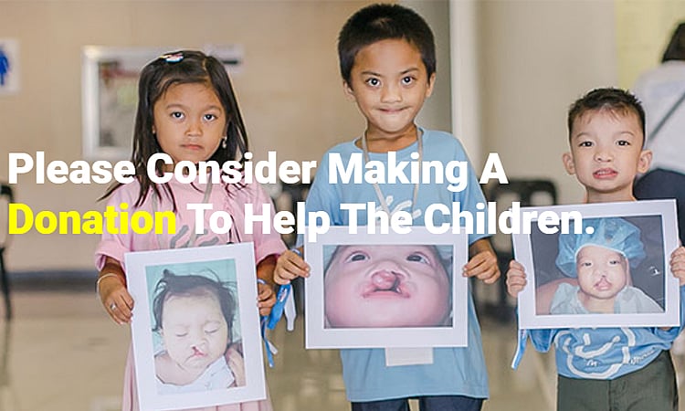 Free Craniofacial Surgeries Now Available in Davao | International Cooperation of Noordhoff Craniofacial Foundation Philippines Offers Assistance to Dabawenyos Dealing with Cleft and Craniofacial Anomalies - Vimarsana News
