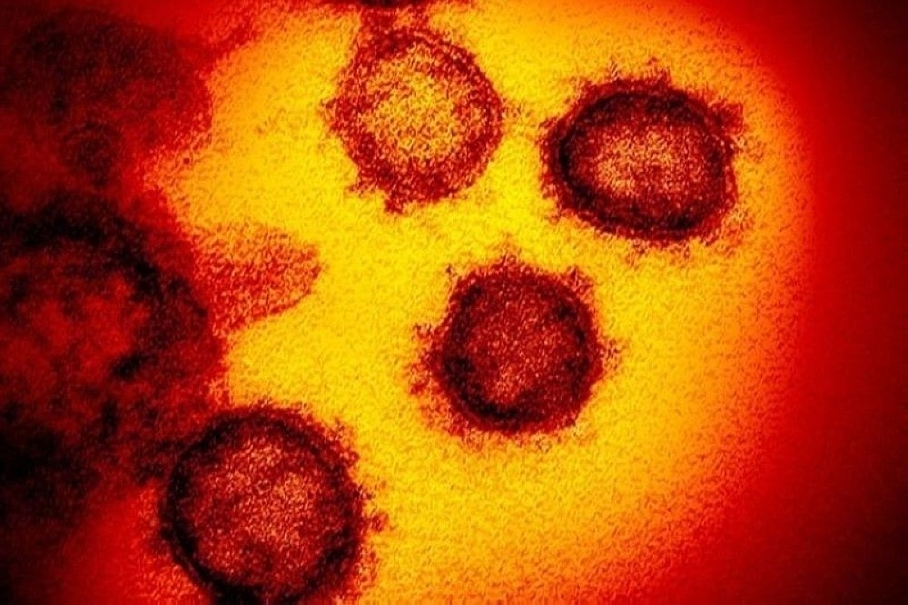 Covid-19 in the Philippines: XBB subvariants and sublineages still dominant - Vimarsana News