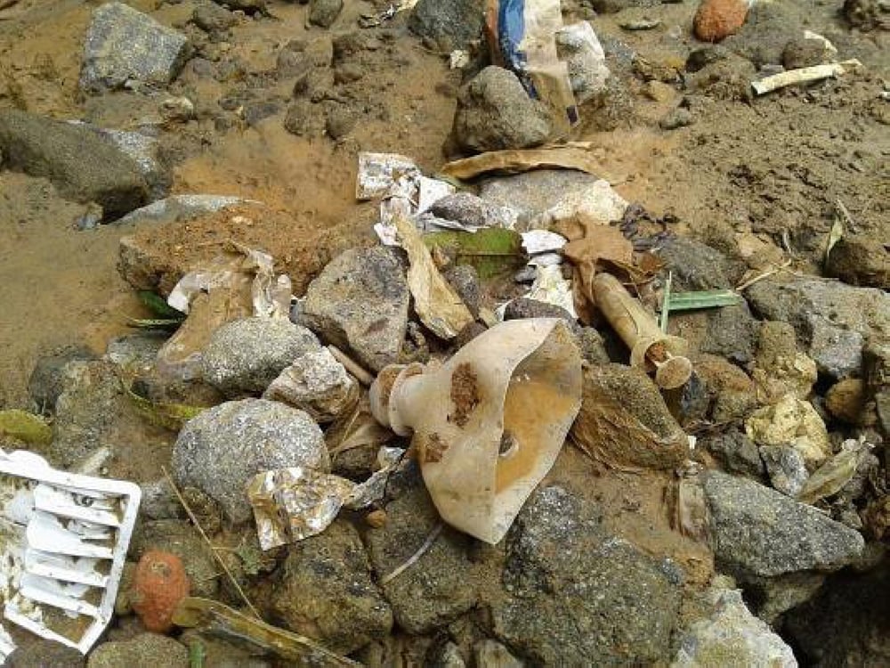 Tuba sues Baguio Medical Center