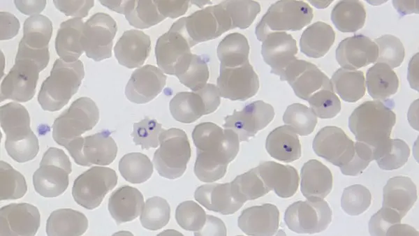 A Discovery That Can Lead Us To A New Drug To Fight Malaria