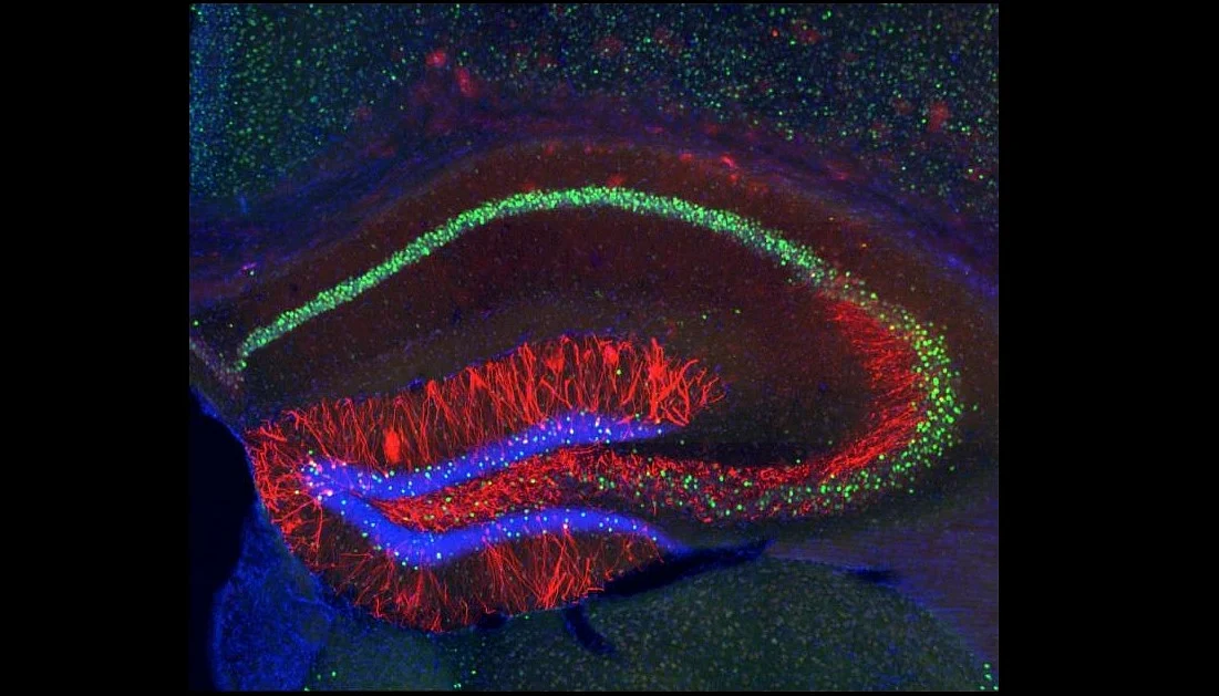 The hippocampus has an intricate, maddeningly complex architecture, which allows it the flexibility needed to rapidly encode memories. It is suspected that this intricacy also predisposes it to seize. Temporal lobe epilepsy, a medical term for seizures originating close to the hippocampus, is the most common seizure disorder in adults. (<a href="http://www.sci-news.com/biology/science-false-memories-mice-01260.html">Sci News</a>)