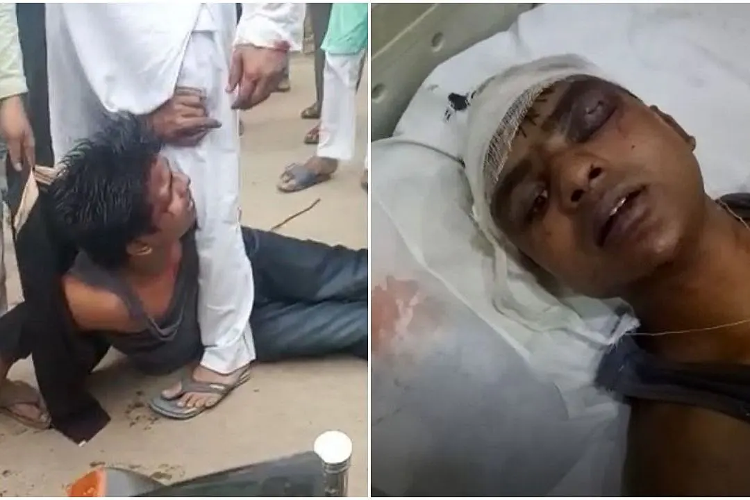 Amethi: Miscreants Molest Dalit Woman, Threaten To Make Her ‘Musalmanni’, Brutally Thrash Husband