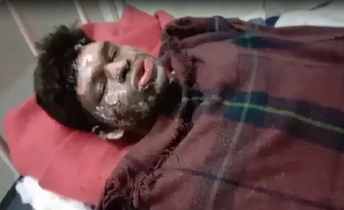 Dhan Prasad after the alleged attack.