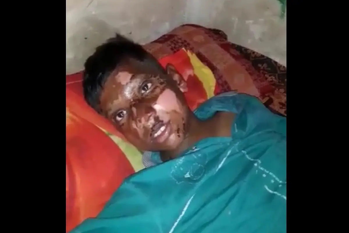 The Worrying Use Of Acid In Delhi Communal Riots