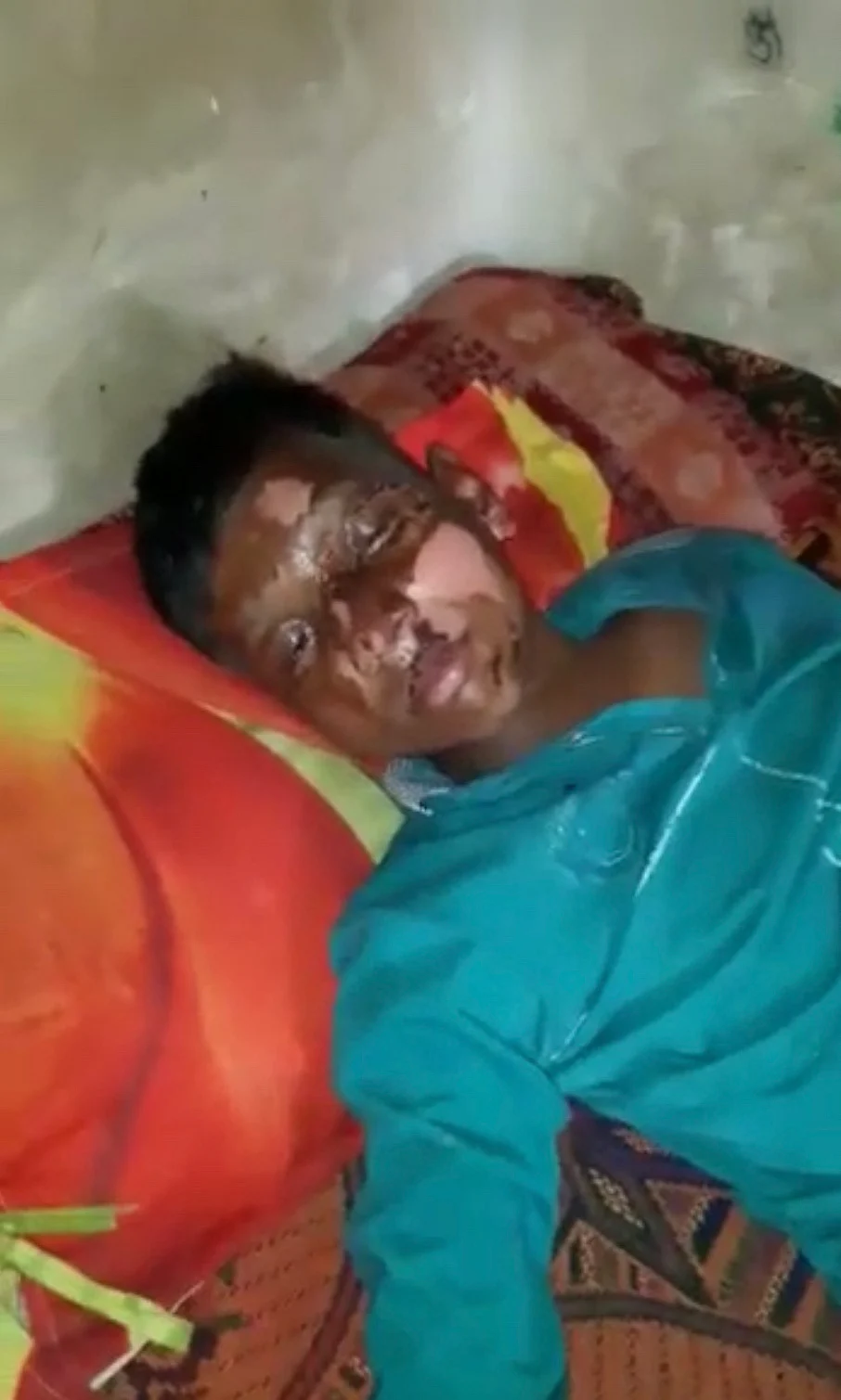 Rahul Giri, a week after the attack