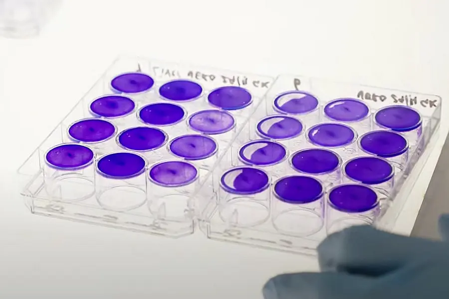 Scientists Develop Experimental Antiviral Therapy To Treat COVID-19, Reduces Viral Load By 99.9 Per Cent
