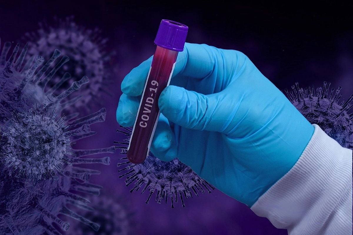 Lab Made Covid19 Strain With 80 Per Cent Mortality Boston University