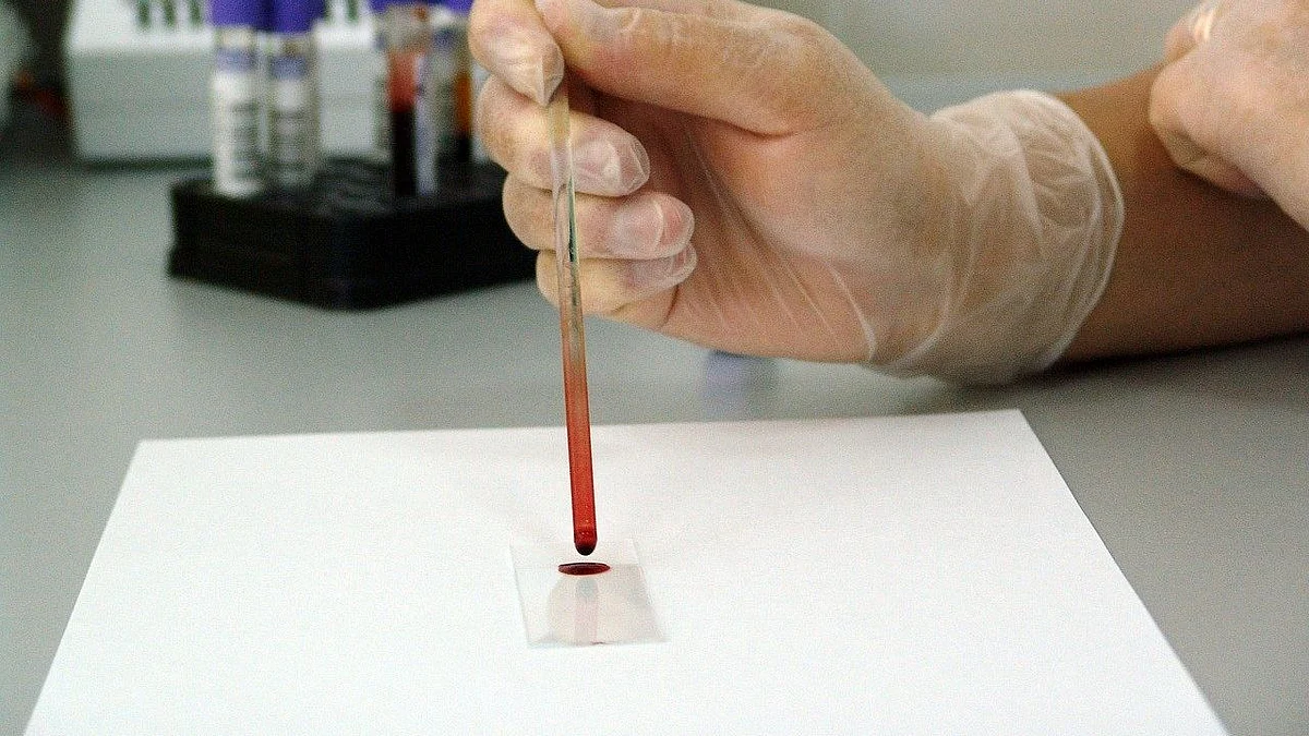 Can a blood test help spot early signs of dementia?