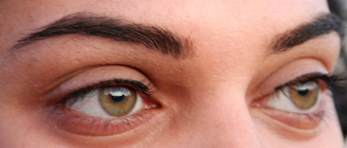 Demand for cornea transplant increases amid pandemic