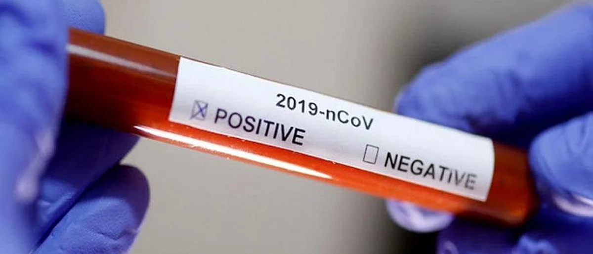 Coronavirus: Global COVID-19 cases at 11.1mn reports Johns Hopkins University