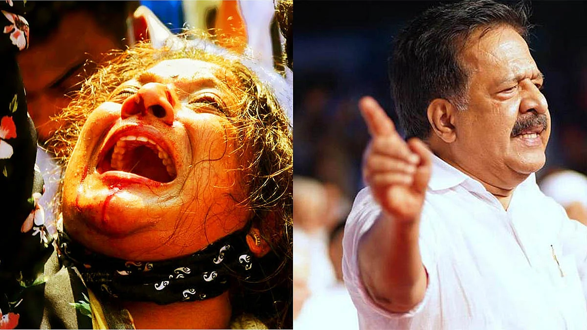 ഇത് കമ്യൂണിസ്റ്റ് ഏകാധിപത്യ രാജ്യമല്ല; പിണറായി പോലീസ് നരനായാട്ട് നടത്തുന്നുവെന്ന് ചെന്നിത്തല