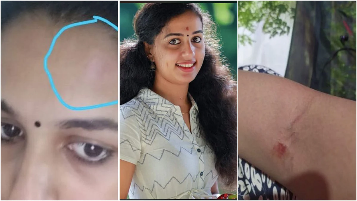 'അടികൊണ്ട് വീണ എന്റെ മുഖത്ത് ചവിട്ടി, കാല് കൊണ്ട് മുഖത്ത് അമർത്തി' കിരണിന്റെ ക്രൂരതകൾ വെളിപ്പെടുത്തുന്ന വിസ്മയയുടെ ചാറ്റ്