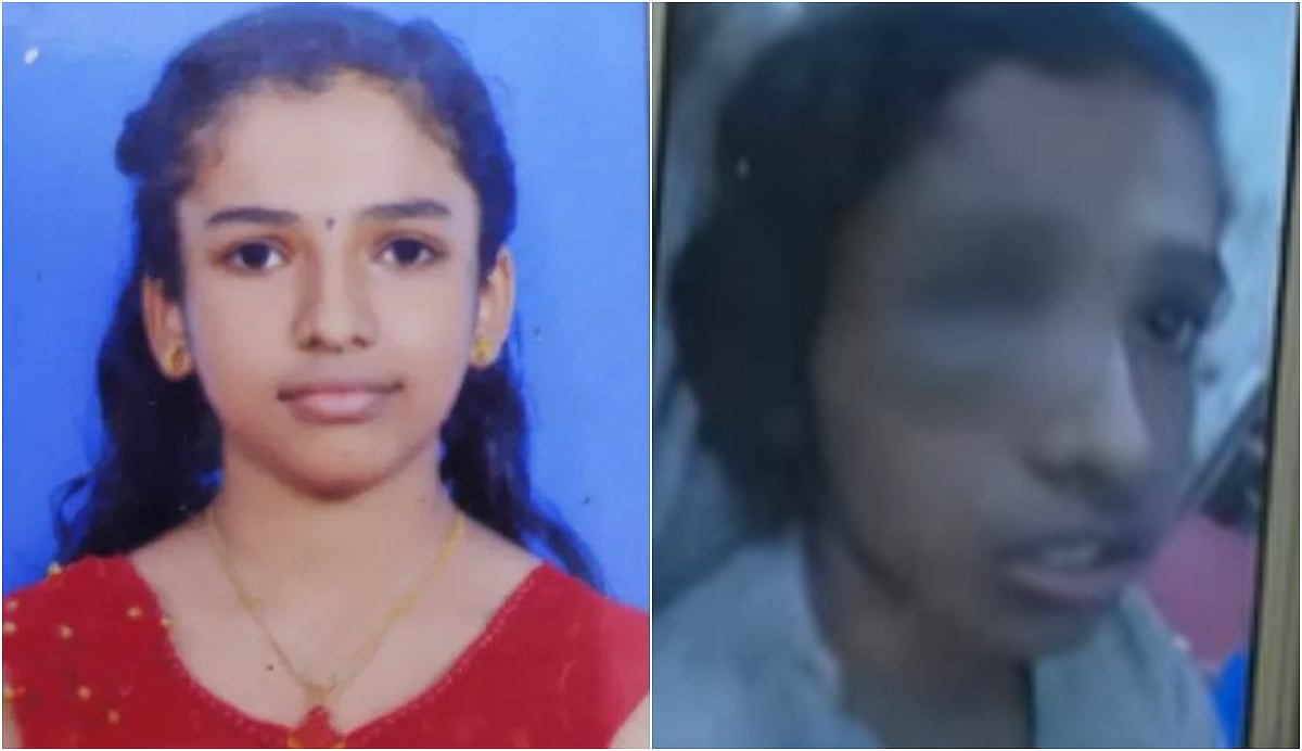 പത്തനംതിട്ടയില് തെരുവ്നായയുടെ കടിയേറ്റ കുട്ടി മരിച്ചു