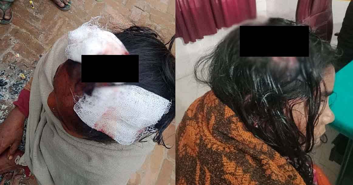 Deadly attack on women of Dalit family