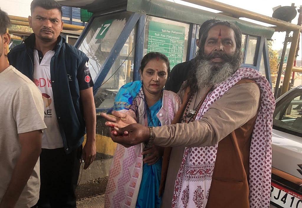 Woman showing hand injury