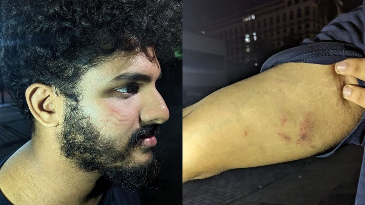 CPI(M) members attack journalist, friend who staged protest at Nava Kerala Sadas - Vimarsana News