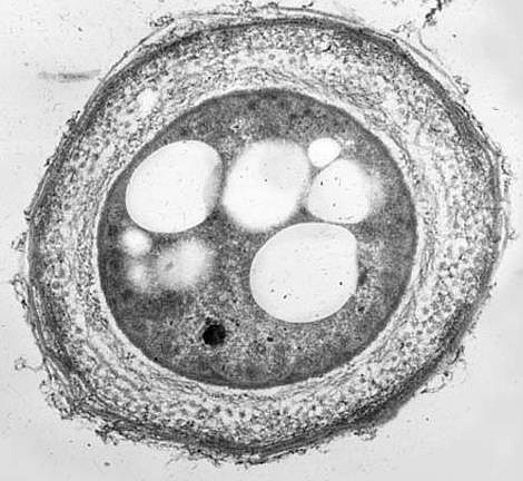 • Azotobacter cyst