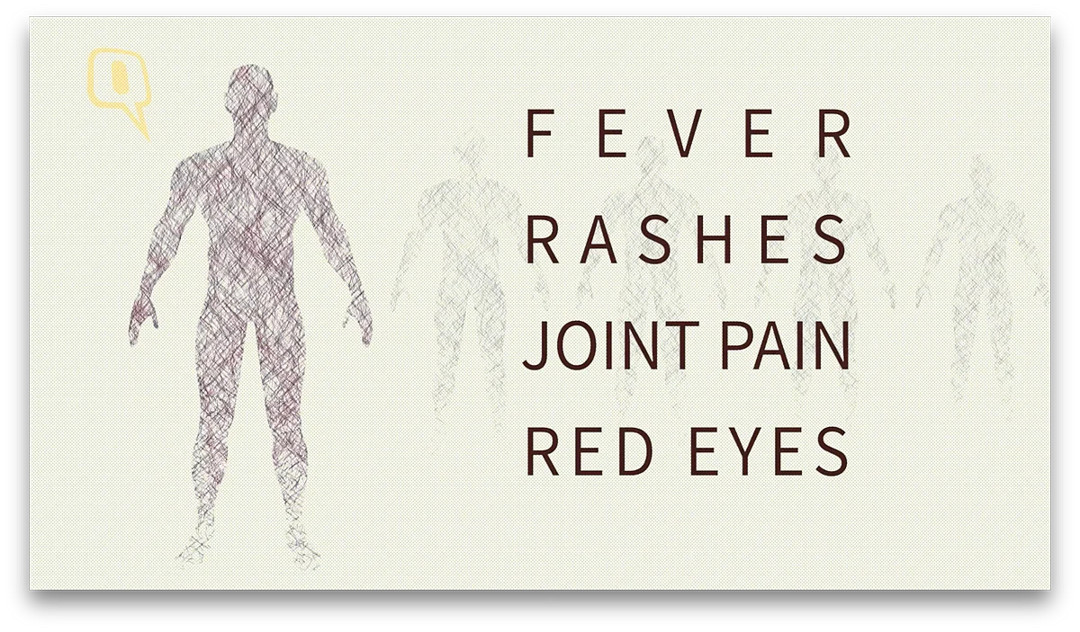 Symptoms of Zika virus