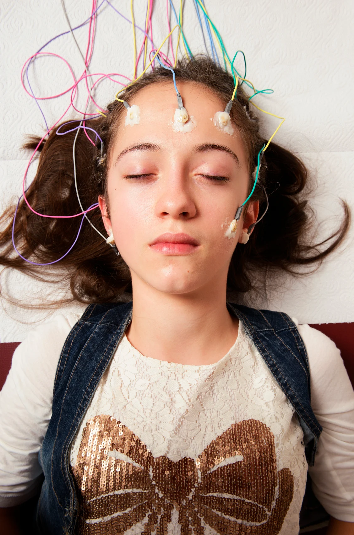 Dravet syndrome can cause mental and physical development delays in kids. Currently there is no cure or standard treatment for it (Photo: iStock)